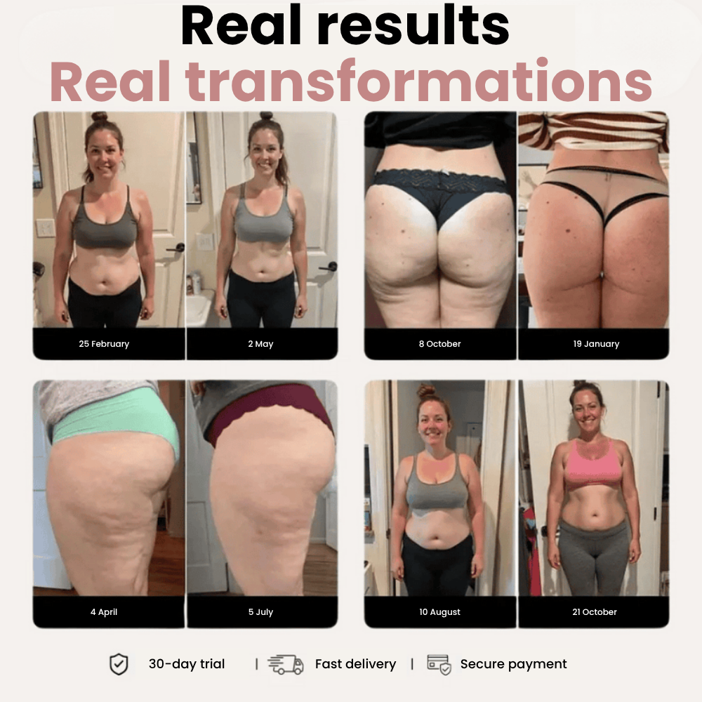 3D Anti-Cellulite Sculpt Leggings – Look Slimmer, Smoother & Lifted in Minutes